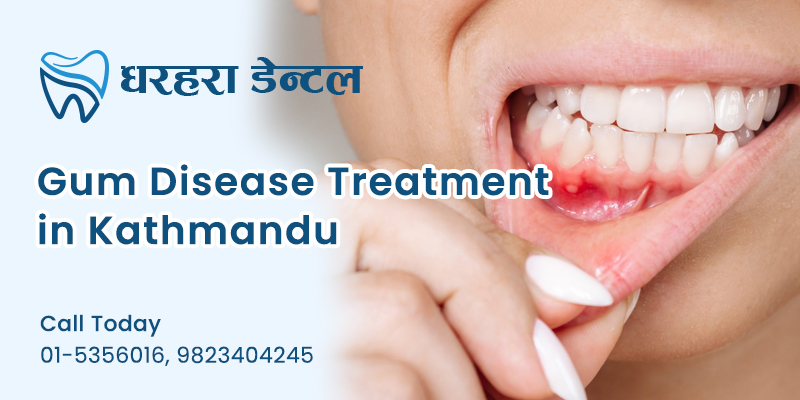 gum diseases treatment in kathmandu