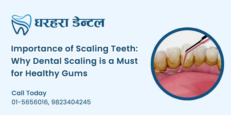 Scaling Teeth