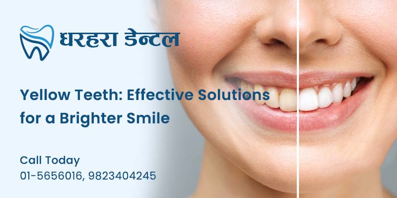 Yellow Teeth Solutions for a Brighter Smile
