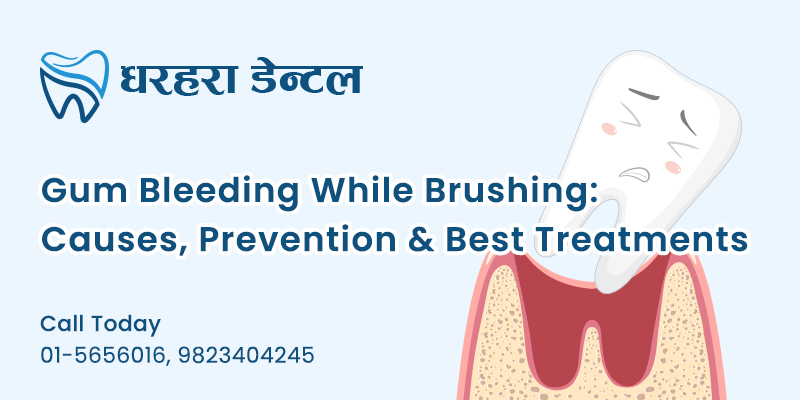 Gum Bleeding Treatment