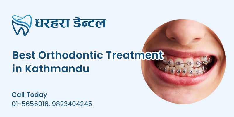 Orthodontic Treatment in Kathmandu