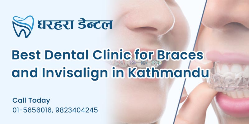 Best Dental Clinic for Braces and Invisalign in Kathmandu