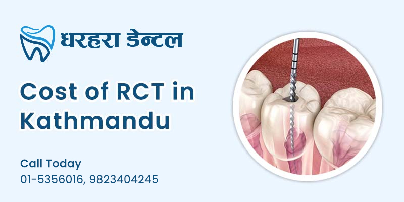 Price of RCT in Kathmandu