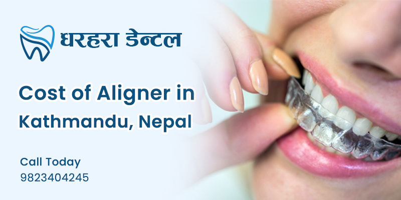 Cost of Aligner in Nepal