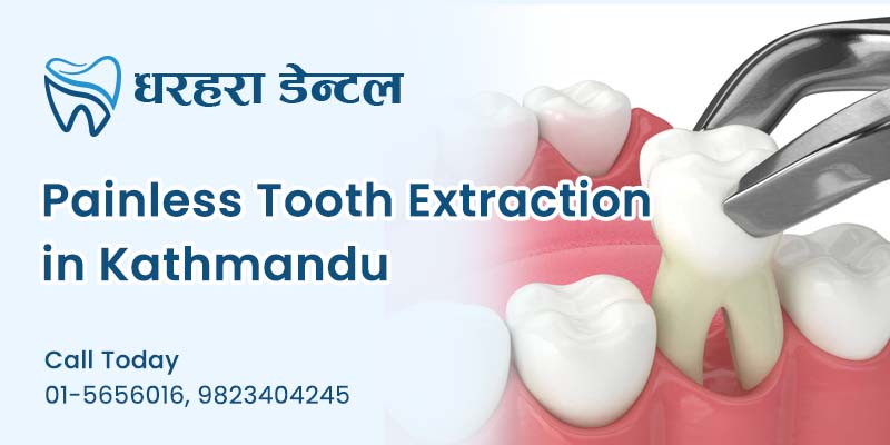 Painless Tooth Extraction in Kathmandu